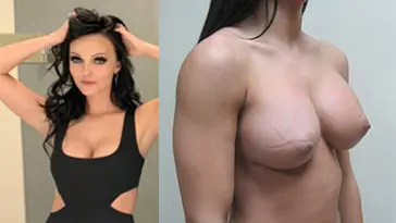 Brittney Atwood — desnuda Boob Job imágenes filtrado